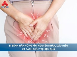 Bị bệnh nấm vùng kín: Nguyên nhân, dấu hiệu và cách điều trị