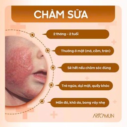 Kem Dưỡng Ẩm Aricamun Moisturizing Cream Giảm Triệu Chứng Chàm Sữa, Viêm Da Cơ Địa Cho Trẻ Sơ Sinh (Tuýp 100g) - thumbnail 6