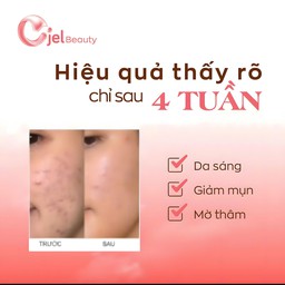 Thạch collagen Cjel Beauty tăng cường độ ẩm và đàn hồi cho da (Hộp 20 gói x 15g)