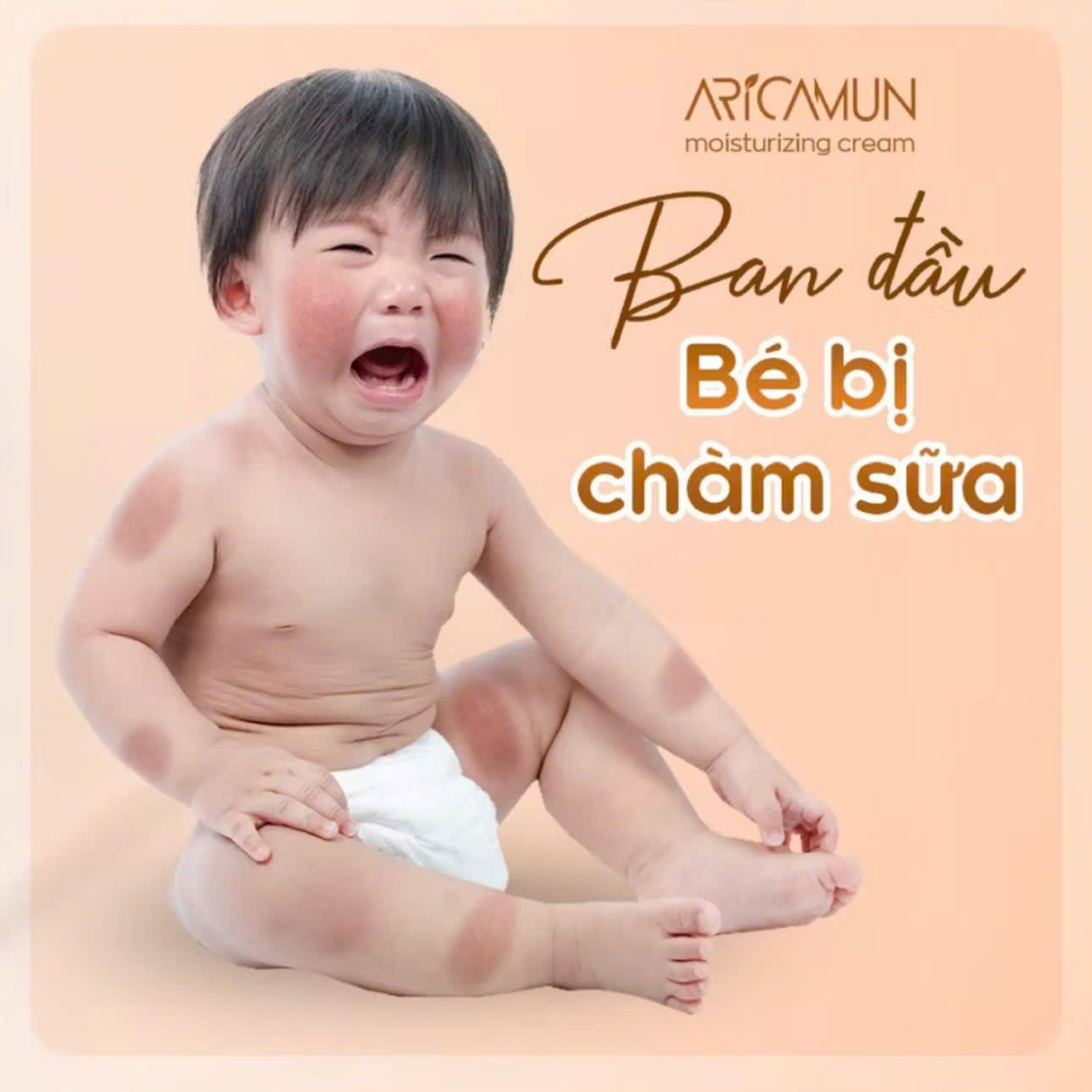 Kem Dưỡng Ẩm Aricamun Moisturizing Cream Giảm Triệu Chứng Chàm Sữa, Viêm Da Cơ Địa Cho Trẻ Sơ Sinh (Tuýp 100g)