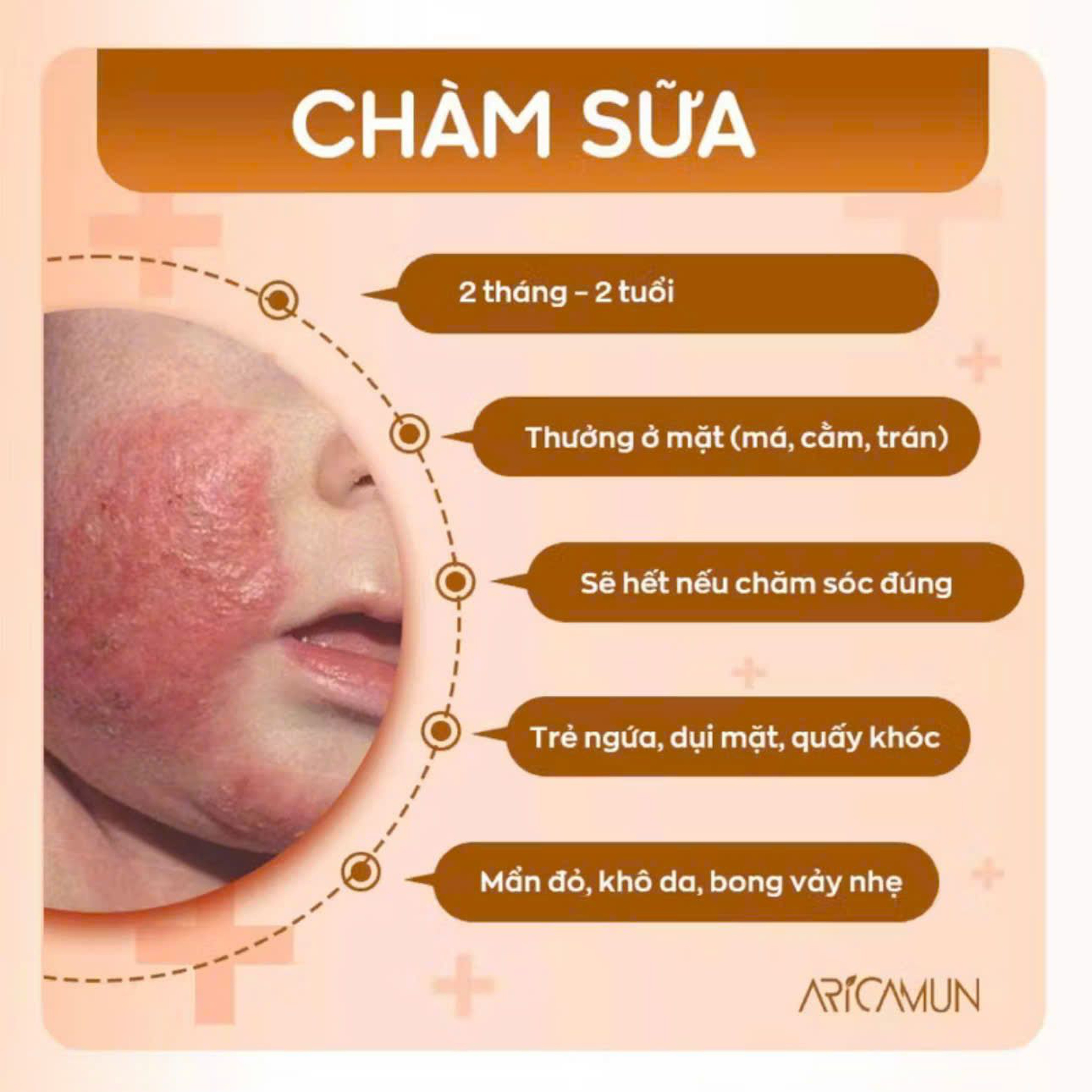 Kem Dưỡng Ẩm Aricamun Moisturizing Cream Giảm Triệu Chứng Chàm Sữa, Viêm Da Cơ Địa Cho Trẻ Sơ Sinh (Tuýp 100g)